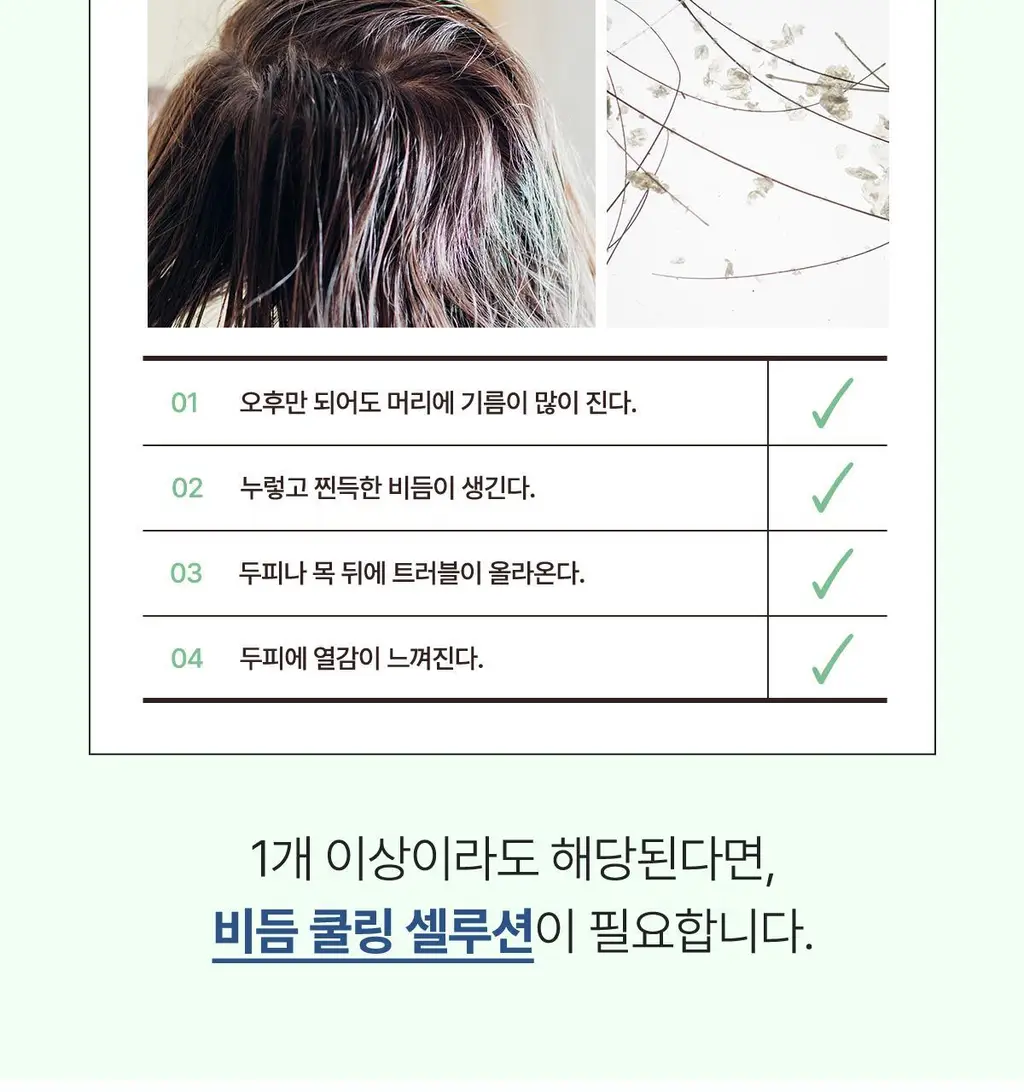 [New/현대약품특허]마이녹셀 댄드러프 스칼프 쿨링 샴푸 480ml 상세페이지 4